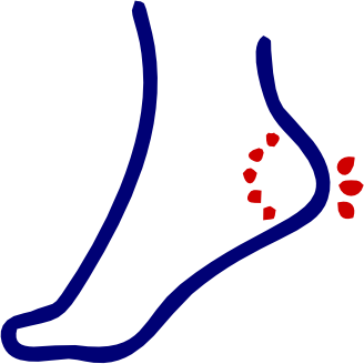 Foot & Ankle Pain